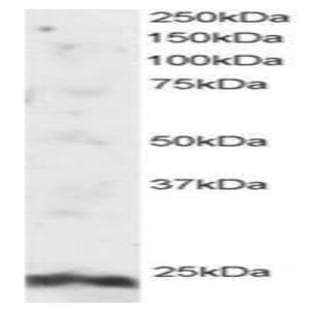 anti-ADP-Ribosylation Factor-Like 4A (ARL4A) (N-Term) antibody avatar