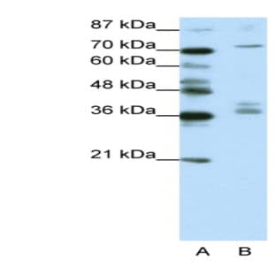 anti-A Kinase (PRKA) Anchor Protein (Yotiao) 9 (AKAP9) (N-Term) antibody avatar