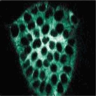 anti-GTPase Activating Protein (SH3 Domain) Binding Protein 1 (G3BP1) (AA 210-323) antibody