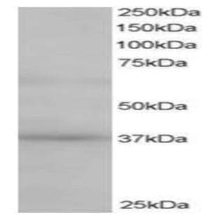 anti-ATPase, H+ Transporting, Lysosomal Accessory Protein 2 (ATP6AP2) (C-Term) antibody avatar