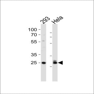 anti-Cyclin-Dependent Kinase 2 (CDK2) (Thr14), (AA 1-30) antibody avatar