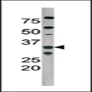anti-Cyclin-Dependent Kinase 2 (CDK2) (pThr160) antibody avatar