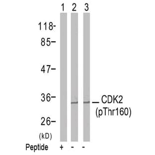 anti-Cyclin-Dependent Kinase 2 (CDK2) (pThr160) antibody avatar