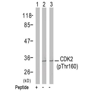 anti-Cyclin-Dependent Kinase 2 (CDK2) (pThr160) antibody avatar