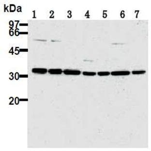 anti-Cyclin-Dependent Kinase 2 (CDK2) antibody avatar