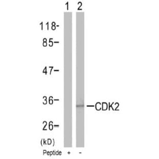 anti-Cyclin-Dependent Kinase 2 (CDK2) (Thr160) antibody avatar
