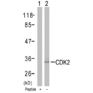 anti-Cyclin-Dependent Kinase 2 (CDK2) (Thr160) antibody avatar