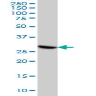 anti-Cyclin-Dependent Kinase 4 (CDK4) (AA 211-304) antibody avatar