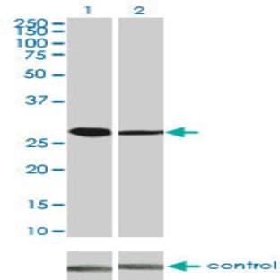 anti-Cyclin-Dependent Kinase 4 (CDK4) (AA 211-304) antibody avatar