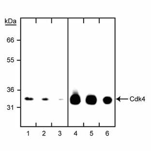 anti-Cyclin-Dependent Kinase 4 (CDK4) antibody avatar