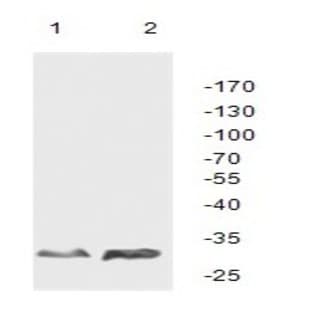 anti-Cyclin-Dependent Kinase 4 (CDK4) antibody avatar