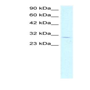 anti-Cyclin-Dependent Kinase 4 (CDK4) (C-Term) antibody avatar