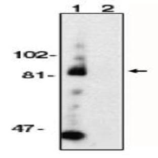 anti-ADAM Metallopeptidase Domain 10 (ADAM10) (AA 732-748) antibody avatar