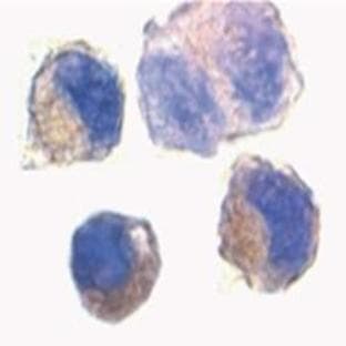 anti-ADAM Metallopeptidase Domain 10 (ADAM10) (AA 732-748) antibody avatar