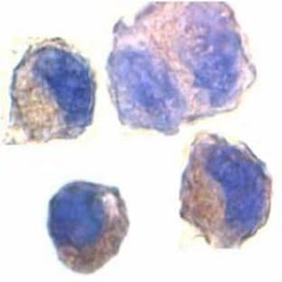 anti-ADAM Metallopeptidase Domain 10 (ADAM10) (C-Term) antibody avatar