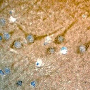 anti-Cyclin-Dependent Kinase 5 (CDK5) (C-Term) antibody avatar