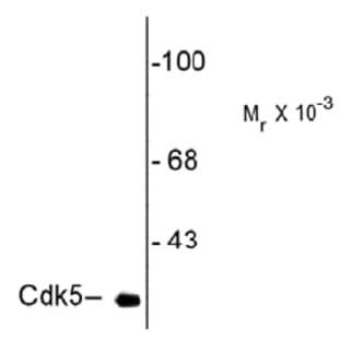 anti-Cyclin-Dependent Kinase 5 (CDK5) antibody avatar