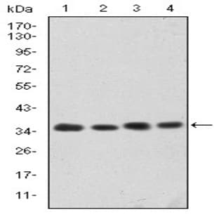 anti-Cyclin-Dependent Kinase 5 (CDK5) antibody avatar