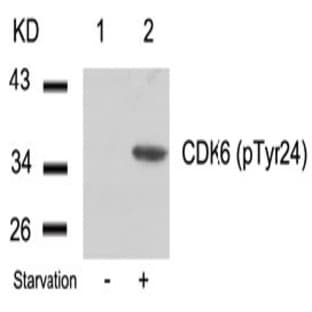 anti-Cyclin-Dependent Kinase 6 (CDK6) (pTyr24) antibody avatar