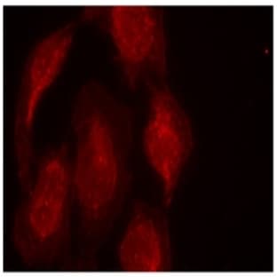 anti-Cyclin-Dependent Kinase 6 (CDK6) (Tyr13) antibody avatar