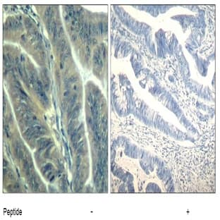 anti-Cyclin-Dependent Kinase 6 (CDK6) (Tyr24) antibody avatar