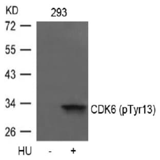 anti-Cyclin-Dependent Kinase 6 (CDK6) (pTyr13) antibody avatar