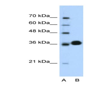 anti-Cyclin-Dependent Kinase 6 (CDK6) (C-Term) antibody avatar