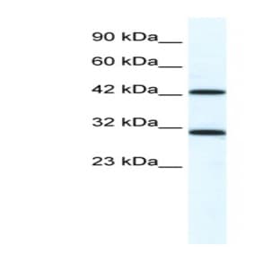 anti-DEAD (Asp-Glu-Ala-Asp) Box Polypeptide 39A (DDX39) (N-Term) antibody avatar