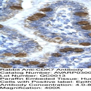 anti-Cyclin-Dependent Kinase 7 (CDK7) (C-Term) antibody avatar