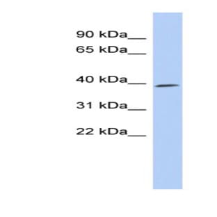 anti-Cyclin-Dependent Kinase 7 (CDK7) (Middle Region) antibody avatar