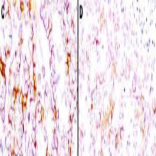 anti-Mesothelin (MSLN) (Extracellular Domain) antibody