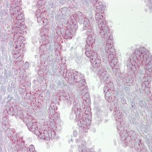 anti-Cyclin-Dependent Kinase 9 (CDK9) (N-Term) antibody avatar