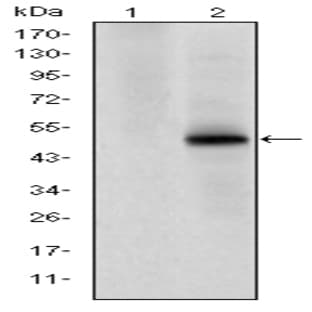 anti-Cyclin-Dependent Kinase 9 (CDK9) antibody avatar