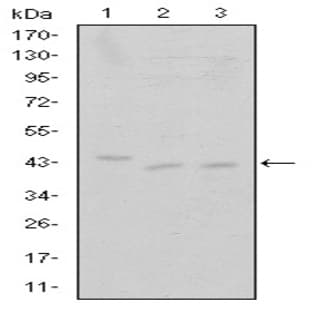 anti-Cyclin-Dependent Kinase 9 (CDK9) antibody avatar