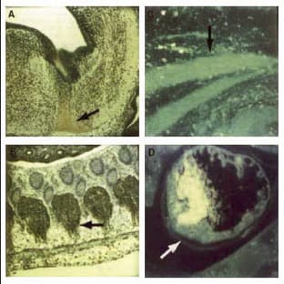 anti-Cyclin-Dependent Kinase 9 (CDK9) (C-Term), (N-Term) antibody avatar