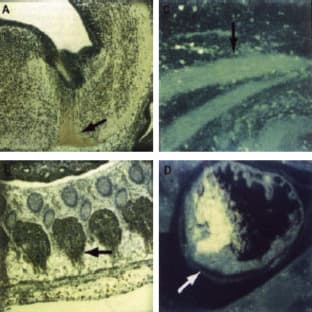 anti-Cyclin-Dependent Kinase 9 (CDK9) (C-Term), (N-Term) antibody avatar