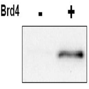 anti-Cyclin-Dependent Kinase 9 (CDK9) (pThr29) antibody avatar