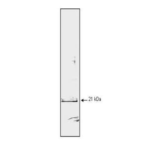 anti-Cyclin-Dependent Kinase Inhibitor 1A (p21, Cip1) (CDKN1A) antibody avatar