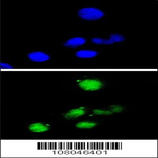 anti-Cyclin-Dependent Kinase Inhibitor 1A (p21, Cip1) (CDKN1A) (AA 105-140), (pSer130) antibody avatar
