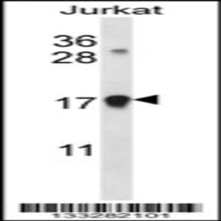 anti-Cyclin-Dependent Kinase Inhibitor 1A (p21, Cip1) (CDKN1A) (C-Term), (AA 117-146) antibody avatar