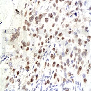 anti-Cyclin-Dependent Kinase Inhibitor 1A (p21, Cip1) (CDKN1A) (C-Term) antibody avatar