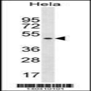 anti-Splicing Factor 3b, Subunit 4, 49kDa (SF3B4) (Center), (AA 158-187) antibody