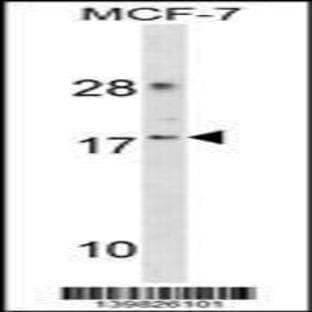 anti-Cyclin-Dependent Kinase 2 Associated Protein 2 (CDK2AP2) (Center), (AA 64-92) antibody avatar