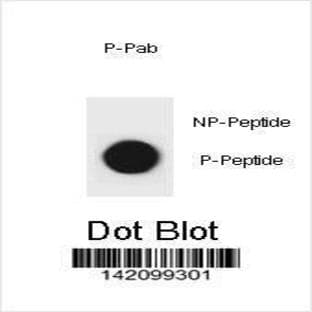 anti-Cyclin-Dependent Kinase Inhibitor 1B (p27, Kip1) (CDKN1B) (pSer140) antibody avatar