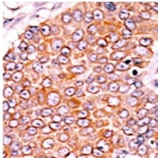 anti-Cyclin-Dependent Kinase Inhibitor 1B (p27, Kip1) (CDKN1B) (pSer10) antibody avatar
