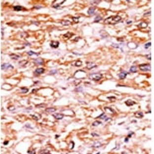anti-Cyclin-Dependent Kinase Inhibitor 1B (p27, Kip1) (CDKN1B) (pSer178) antibody avatar