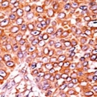 anti-Cyclin-Dependent Kinase Inhibitor 1B (p27, Kip1) (CDKN1B) (pThr157) antibody avatar