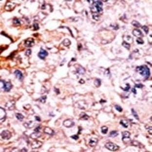 anti-Cyclin-Dependent Kinase Inhibitor 1B (p27, Kip1) (CDKN1B) (pThr187) antibody avatar