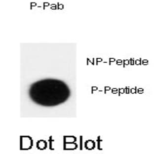 anti-Cyclin-Dependent Kinase Inhibitor 1B (p27, Kip1) (CDKN1B) (pThr198) antibody avatar