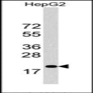 anti-Cyclin-Dependent Kinase Inhibitor 1B (p27, Kip1) (CDKN1B) (C-Term) antibody avatar
